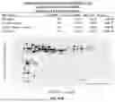 Fig. 217 - METHODS AND SYSTEMS FOR MACHINE LEARNING ANALYSIS OF SINGLE NUCLEOTIDE POLYMORPHISMS IN LUPUS