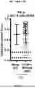 Fig. 62 - METHODS AND SYSTEMS FOR MACHINE LEARNING ANALYSIS OF SINGLE NUCLEOTIDE POLYMORPHISMS IN LUPUS