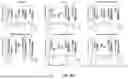 Fig. 83 - METHODS AND SYSTEMS FOR MACHINE LEARNING ANALYSIS OF SINGLE NUCLEOTIDE POLYMORPHISMS IN LUPUS