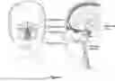 Fig. 02 - Methods and Devices for Alleviating Disorders Associated with Sinus Cavities
