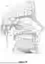 Fig. 04 - Methods and Devices for Alleviating Disorders Associated with Sinus Cavities