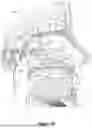 Fig. 05 - Methods and Devices for Alleviating Disorders Associated with Sinus Cavities