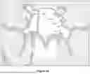Fig. 06 - Methods and Devices for Alleviating Disorders Associated with Sinus Cavities