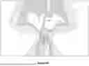 Fig. 09 - Methods and Devices for Alleviating Disorders Associated with Sinus Cavities
