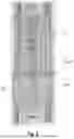 Fig. 05 - ABSORBENT ARTICLE WITH NARROW STABILIZATION ELEMENT