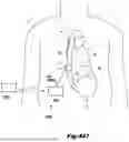 Fig. 366 - METHODS AND DEVICES FOR SECURE COMMUNICATION WITH AND OPERATION OF AN IMPLANT