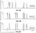Fig. 07 - Methods of Production of Double Unsaturated Pheromones Using Metabolic Pathways
