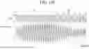 Fig. 136 - STYLUS PEN, ANTENNA MODULE, TOUCH SENSOR, AND ELECTRONIC DEVICE