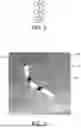 Fig. 03 - IDENTIFYING STENT DEFORMATIONS
