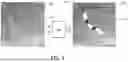 Fig. 05 - IDENTIFYING STENT DEFORMATIONS