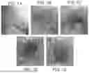 Fig. 02 - DEVICE AND METHOD FOR ENHANCED VISUALIZATION OF THE SMALL INTESTINE