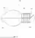Fig. 04 - DEVICE AND METHOD FOR ENHANCED VISUALIZATION OF THE SMALL INTESTINE