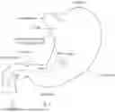 Fig. 17 - DEVICE AND METHOD FOR ENHANCED VISUALIZATION OF THE SMALL INTESTINE