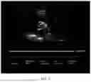 Fig. 03 - CARDIAC IMAGE ANALYSIS