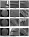 Fig. 02 - BRIDGING PERIPHERAL NERVE GAPS WITH CONDUITS FOR ENHANCED NERVE REGENERATION