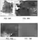 Fig. 22 - BRIDGING PERIPHERAL NERVE GAPS WITH CONDUITS FOR ENHANCED NERVE REGENERATION