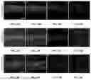 Fig. 28 - BRIDGING PERIPHERAL NERVE GAPS WITH CONDUITS FOR ENHANCED NERVE REGENERATION