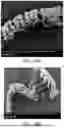 Fig. 33 - BRIDGING PERIPHERAL NERVE GAPS WITH CONDUITS FOR ENHANCED NERVE REGENERATION