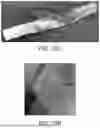 Fig. 40 - BRIDGING PERIPHERAL NERVE GAPS WITH CONDUITS FOR ENHANCED NERVE REGENERATION