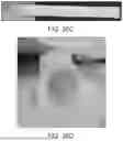 Fig. 44 - BRIDGING PERIPHERAL NERVE GAPS WITH CONDUITS FOR ENHANCED NERVE REGENERATION