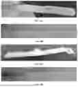 Fig. 47 - BRIDGING PERIPHERAL NERVE GAPS WITH CONDUITS FOR ENHANCED NERVE REGENERATION