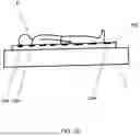 Fig. 11 - TEMPORARY BLOOD VESSEL OCCLUSION DEVICE AND METHOD