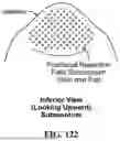 Fig. 131 - HANDED SPIRAL SLOTTED SCALPET ARRAY