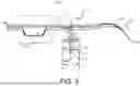 Fig. 04 - SHUNTING CATHETERS
