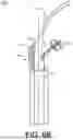Fig. 08 - SHUNTING CATHETERS