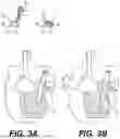 Fig. 03 - ORTHOPEDIC STABILIZATION DEVICES AND METHODS FOR INSTALLATION THEREOF