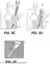 Fig. 04 - ORTHOPEDIC STABILIZATION DEVICES AND METHODS FOR INSTALLATION THEREOF