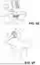 Fig. 08 - ORTHOPEDIC STABILIZATION DEVICES AND METHODS FOR INSTALLATION THEREOF
