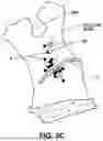 Fig. 06 - Systems and methods for therapeutic nasal treatment using handheld device