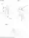 Fig. 09 - INSTRUMENTS AND METHODS FOR POSTERIOR SURGICAL APPROACH FOR SACROILIAC JOINT