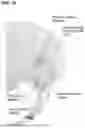 Fig. 42 - INSTRUMENTS AND METHODS FOR POSTERIOR SURGICAL APPROACH FOR SACROILIAC JOINT