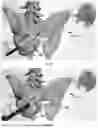 Fig. 45 - INSTRUMENTS AND METHODS FOR POSTERIOR SURGICAL APPROACH FOR SACROILIAC JOINT