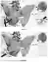 Fig. 48 - INSTRUMENTS AND METHODS FOR POSTERIOR SURGICAL APPROACH FOR SACROILIAC JOINT