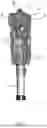Fig. 02 - PROSTHETIC DEVICE