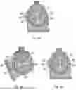 Fig. 08 - PROSTHETIC DEVICE
