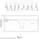 Fig. 09 - PROSTHETIC DEVICE