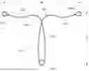 Fig. 01 - Intrauterine Contraceptive Device