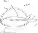 Fig. 02 - CAPSULOTOMY DEVICE
