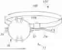 Fig. 01 - Elastomeric Enteral Feeding Pump and Filling System