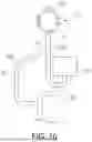 Fig. 09 - Elastomeric Enteral Feeding Pump and Filling System