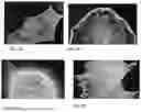 Fig. 03 - Genetically Engineered Phagocytes, and Related Compositions, Vectors, Methods and Systems