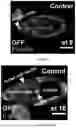 Fig. 12 - Genetically Engineered Phagocytes, and Related Compositions, Vectors, Methods and Systems