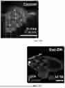 Fig. 13 - Genetically Engineered Phagocytes, and Related Compositions, Vectors, Methods and Systems