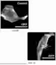Fig. 14 - Genetically Engineered Phagocytes, and Related Compositions, Vectors, Methods and Systems