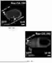 Fig. 15 - Genetically Engineered Phagocytes, and Related Compositions, Vectors, Methods and Systems