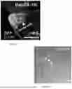 Fig. 16 - Genetically Engineered Phagocytes, and Related Compositions, Vectors, Methods and Systems